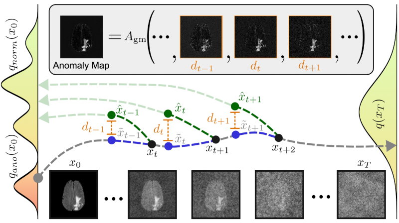 Unsupervised Anomaly Detection in Medical Imaging using Aggregated Normative Diffusion